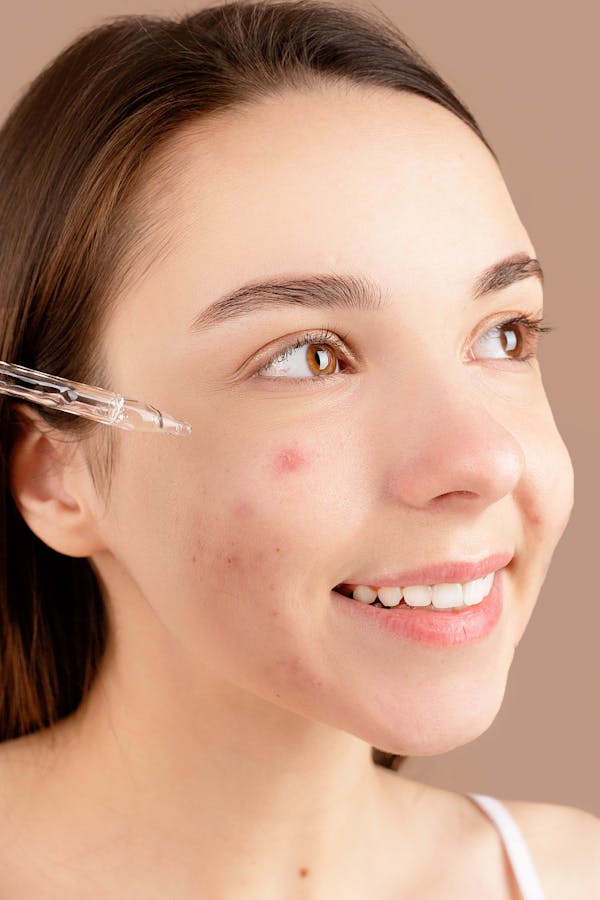 ACNE & BLEMISHES - Thank Me Now